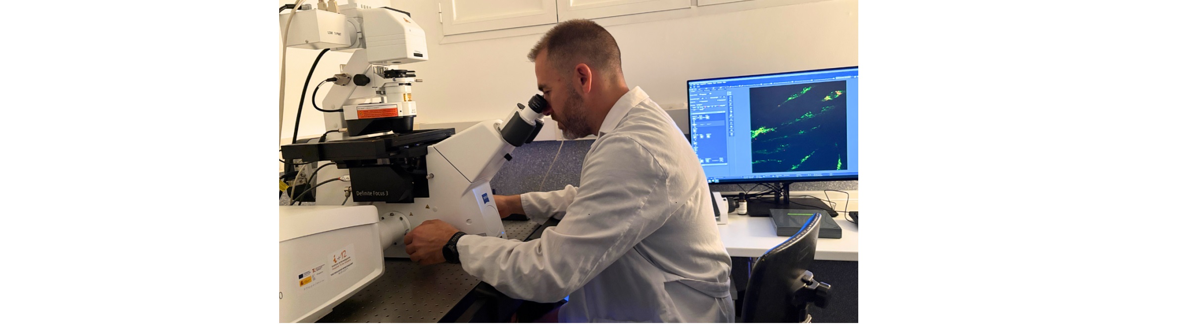 El Instituto i+12, primero de España con un microscopio capaz de observar células vivas y estructuras subcelulares con un detalle sin precedentes