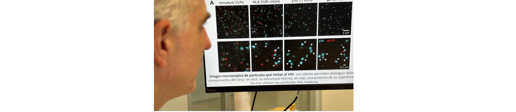Investigadores del Instituto i+12 ayudan a descifrar cómo el VIH reorganiza la superficie de las células para facilitar la infección