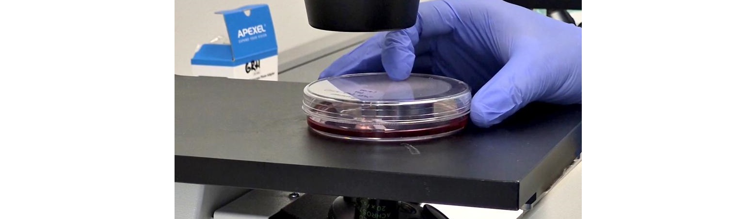 Investigadores/as del Instituto i+12 demuestran la viabilidad y eficacia de una vacuna oral contra una variante del virus del Ébola