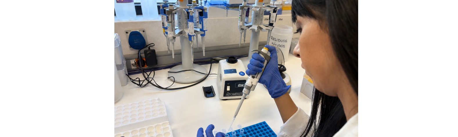 Investigadores/as del Instituto i+12 lideran un nuevo método para predecir recaídas inminentes en pacientes con mieloma múltiple