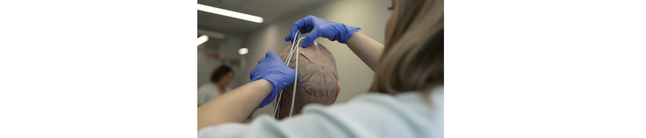 El Instituto i+12 participa en un ensayo clínico internacional para mejorar el tratamiento del glioblastoma recién diagnosticado