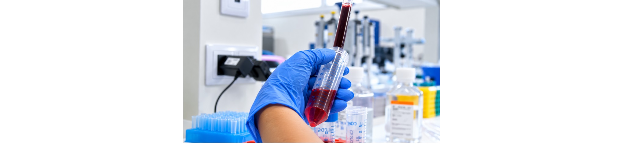 El proyecto PROCURE, liderado por un investigador del i+12, identifica variantes genéticas asociadas al riesgo de neumonitis en pacientes con cáncer de mama